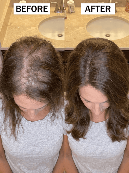 Veyra™ The Inside + Out Growth System