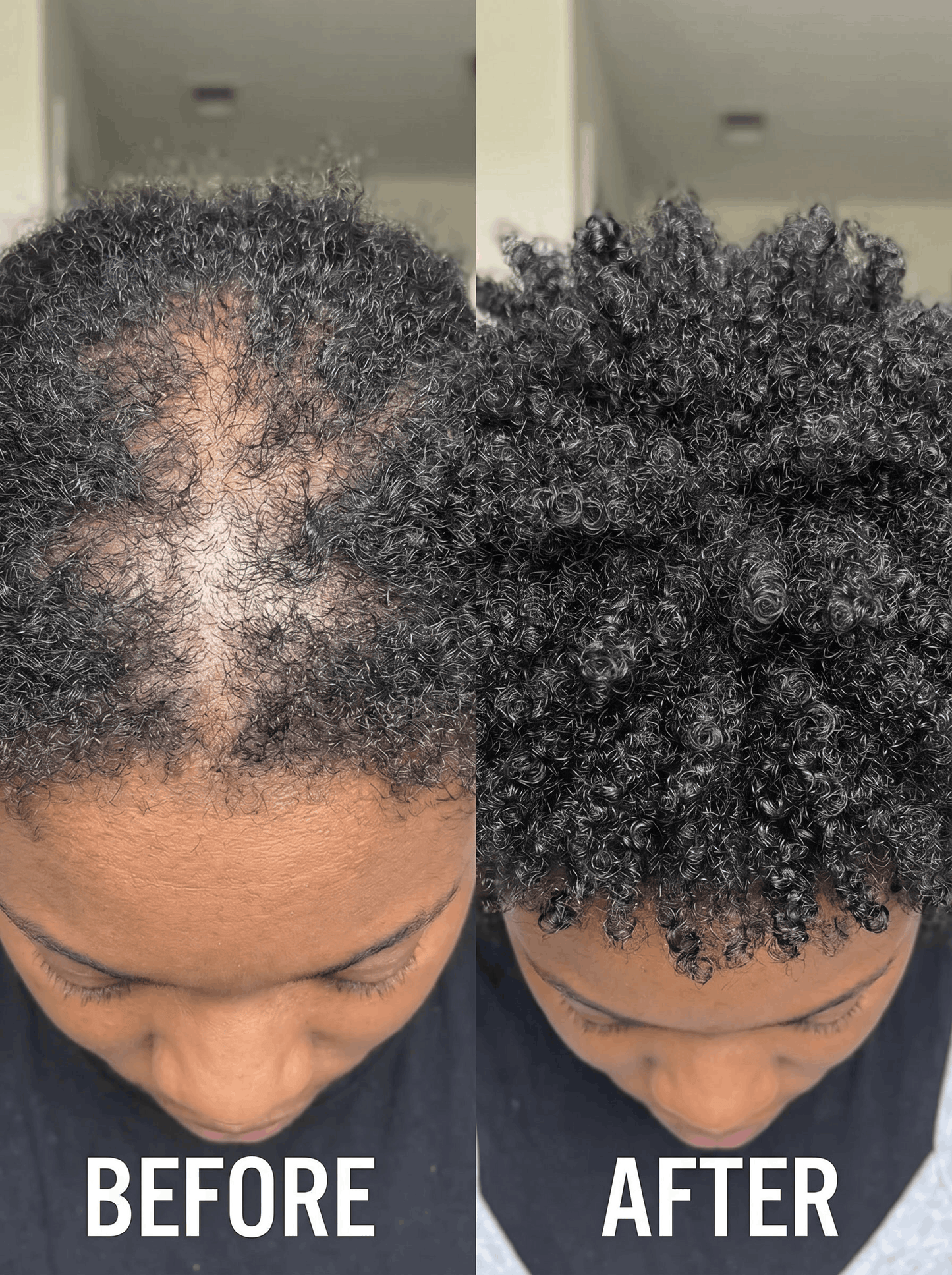 Veyra™ The Inside + Out Growth System