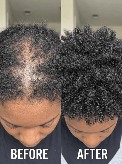 Veyra™ The Inside + Out Growth System
